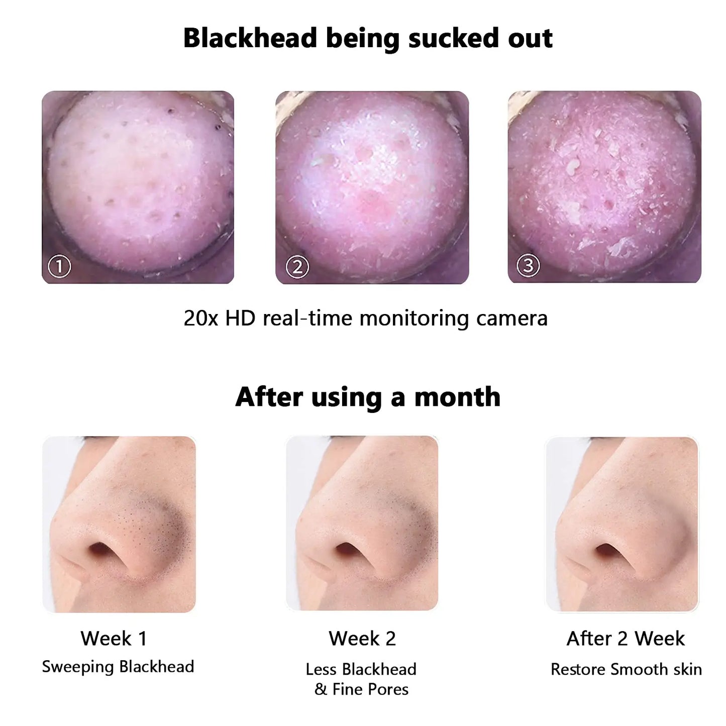 Visual Electric Blackhead Remover